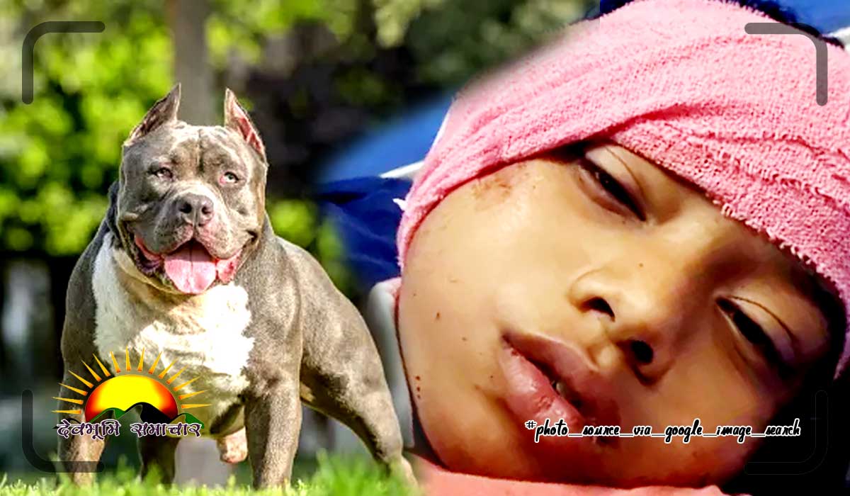 pitbull-attack